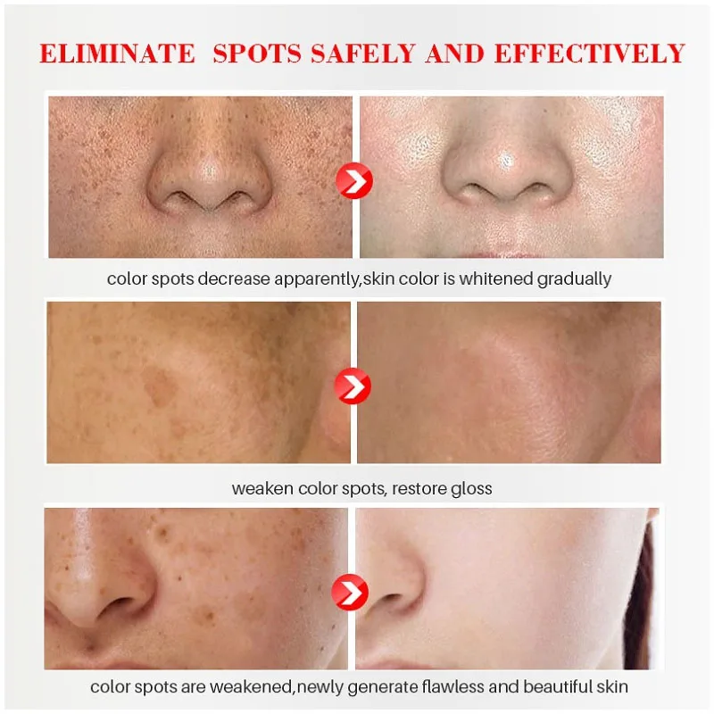 Effective Whitening Freckles C - Licorice Root Sticks review and price