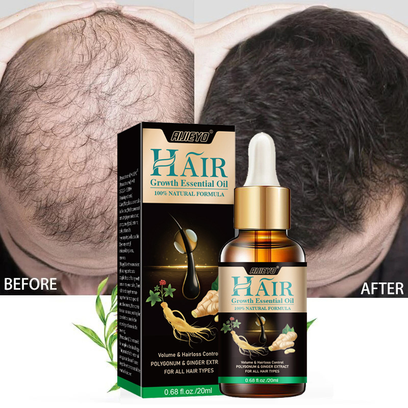 2023 Biotin Fast Hair Growth O - Licorice Root Sticks review and price