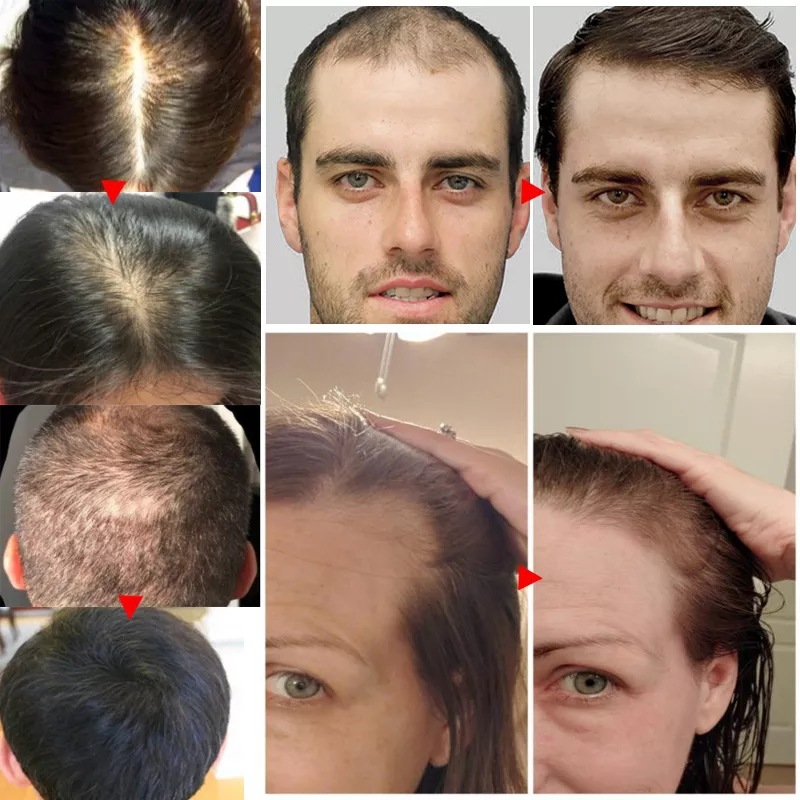 2023 Biotin Fast Hair Growth O - Licorice Root Sticks review and price