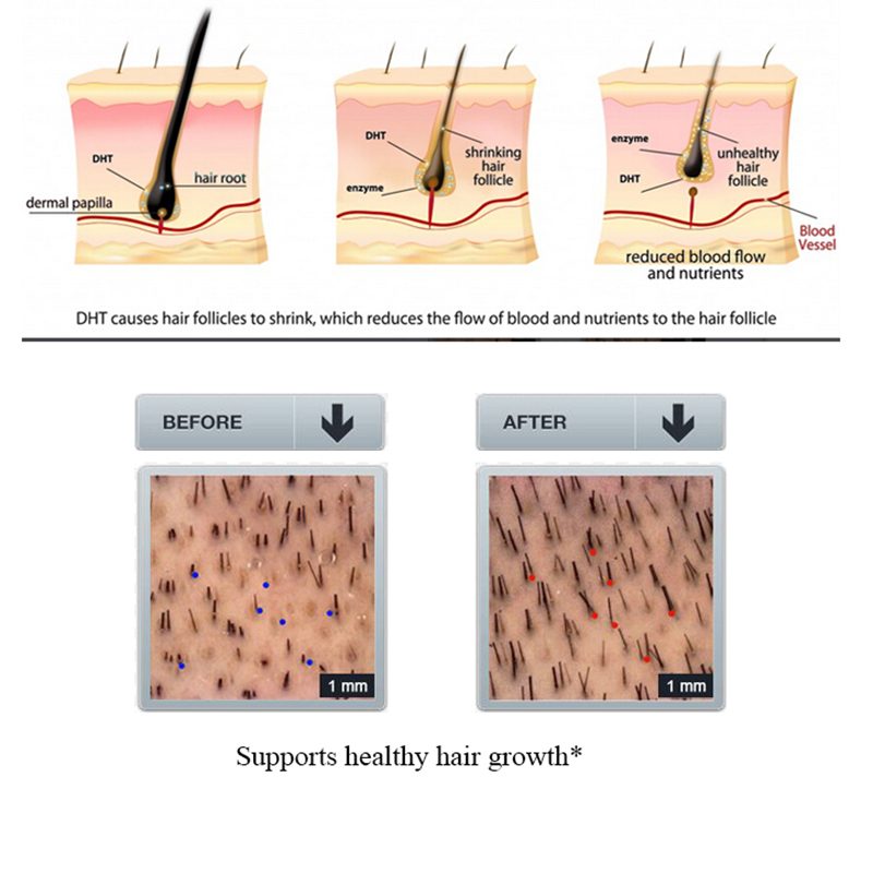 PURC 100ml Ginger Hair Loss Sh - Licorice Root Sticks review and price